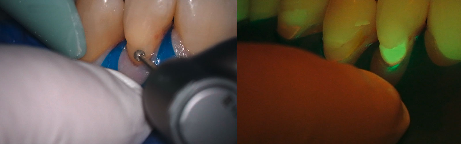 zeiss-utan-och-med-fluoroscense-1600x500.jpg