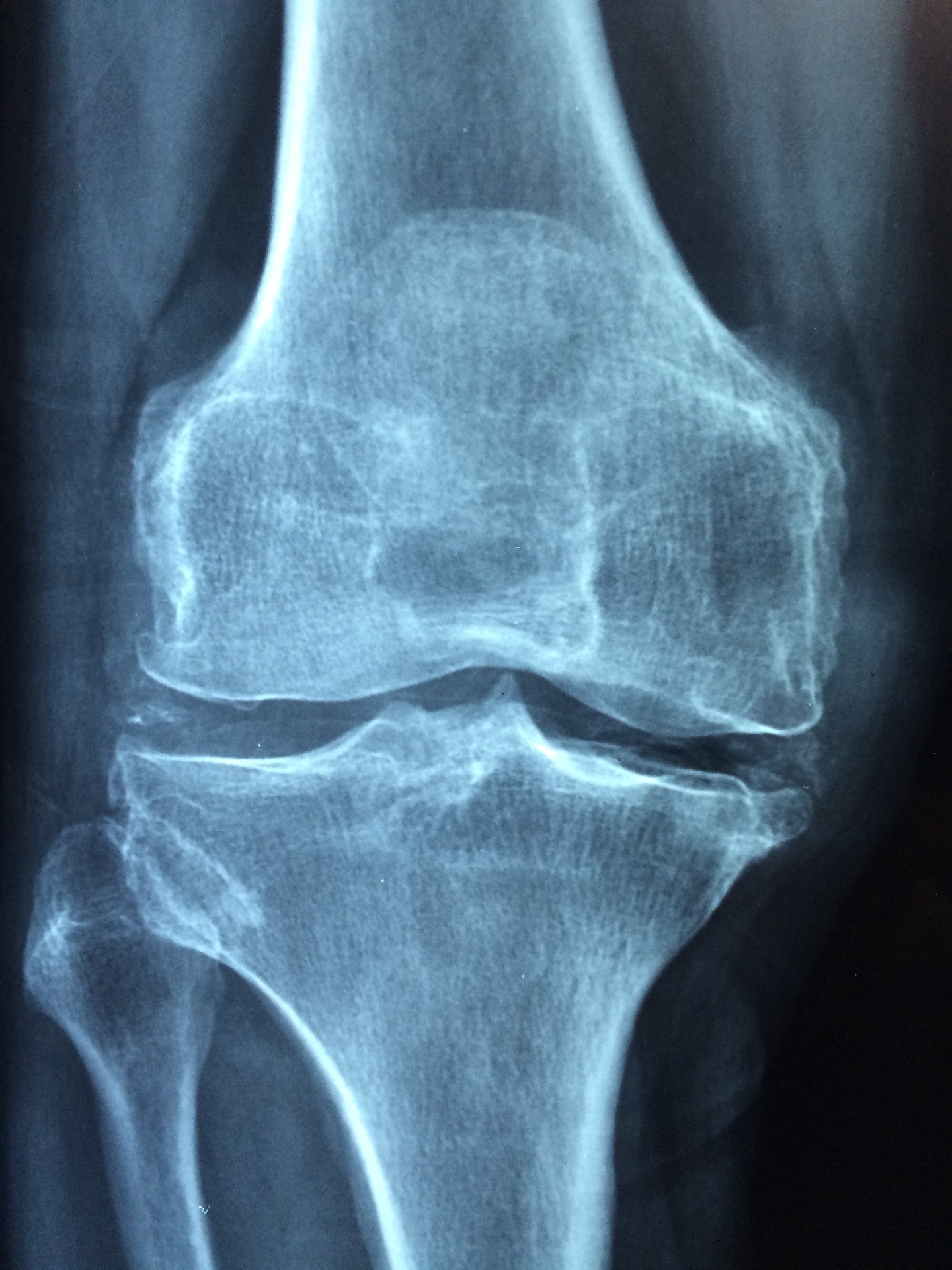 knee-1406964_1920.jpg